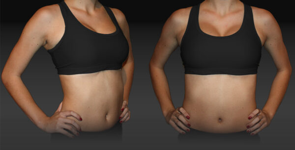 Cheer Sport Bra <br> - Training Outfit